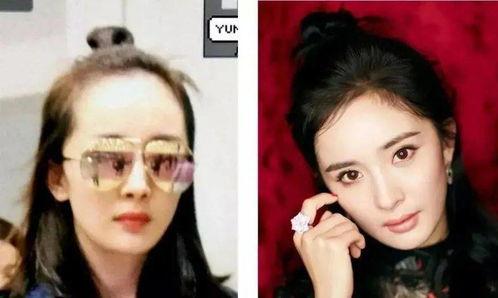 明星网红谈植发经历,揭秘明星逆龄秘诀